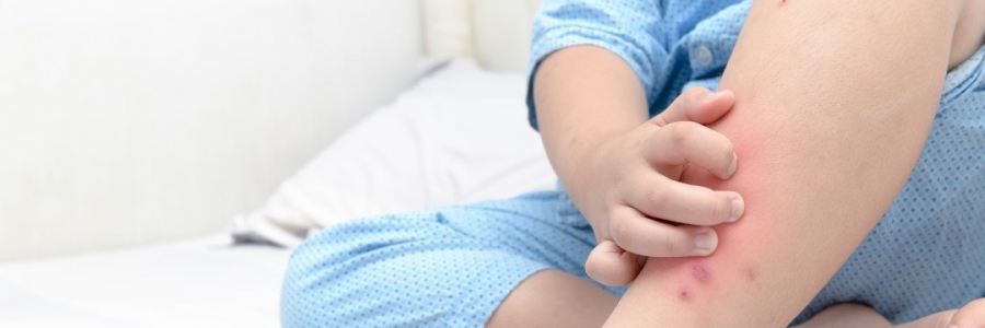 學(xué)古人這樣驅(qū)蚊，從此不再“蚊”風(fēng)喪膽！